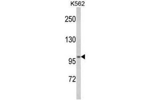 Western blot analysis of ATP12A Antibody (Center) in K562 cell line lysates (35ug/lane). (ATP12A antibody  (Middle Region))