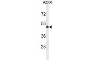 Western Blotting (WB) image for anti-Eyes Absent Homolog 4 (EYA4) antibody (ABIN3004136) (EYA4 antibody)