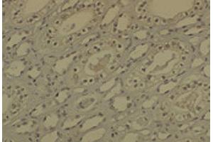 Immunohistochemistry analysis using Mouse Anti-DNMT1 Monoclonal Antibody, Clone 60B1220. (DNMT1 antibody  (AA 637-650))