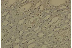 Immunohistochemistry analysis using Mouse Anti-DNMT1 Monoclonal Antibody, Clone 60B1220.