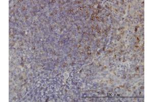 Immunoperoxidase of monoclonal antibody to USP33 on formalin-fixed paraffin-embedded human tonsil. (USP33 antibody  (AA 327-426))