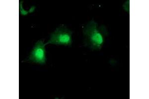 Anti-MPI mouse monoclonal antibody (ABIN2455793) immunofluorescent staining of COS7 cells transiently transfected by pCMV6-ENTRY MPI (RC208134). (MPI antibody)