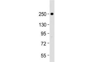 Western blot testing of human U-87 MG cell lysate with SCN1A antibody at 1:2000.
