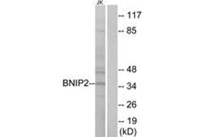 Western Blotting (WB) image for anti-BCL2/adenovirus E1B 19kDa Interacting Protein 2 (BNIP2) (AA 265-314) antibody (ABIN2890156) (BNIP2 antibody  (AA 265-314))