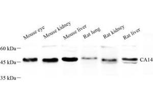 Western blot analysis of CA14 (ABIN7073311) at dilution of 1: 500 (CA14 antibody)