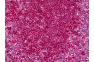 Anti-GPR35 antibody IHC of human tonsil. (GPR35 antibody)