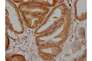 IHC image of ABIN7127838 diluted at 1:100 and staining in paraffin-embedded human prostate tissue performed on a Leica BondTM system. (Recombinant TPT1 antibody)