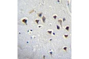 Immunohistochemistry analysis in formalin fixed and paraffin embedded human brain tissue reacted with NMDA Receptor 2A Antibody (Center) followed by peroxidase conjugation of the secondary antibody and DAB staining. (NMDAR2A antibody  (Middle Region))