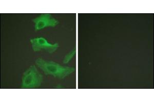 Immunofluorescence analysis of HeLa cells, treated with TNF-a (20nM, 15 mins), using HSP90B (Ab-254) antibody. (HSP90AB1 antibody)