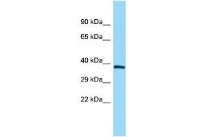 WB Suggested Anti-GPR160 Antibody Titration: 1.