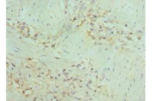 Immunohistochemistry of paraffin-embedded human gallbladder tissue using ABIN7150715 at dilution of 1:100 (MAP2K5 antibody  (AA 1-190))