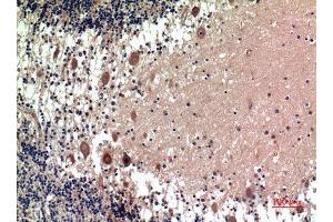 Immunohistochemistry (IHC) analysis of paraffin-embedded Human Brain, antibody was diluted at 1:100. (5HT1D antibody)