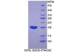 SDS-PAGE (SDS) image for Bone Morphogenetic Protein Receptor, Type II (serine/threonine Kinase) (BMPR2) (AA 27-150) protein (His tag) (ABIN1878286) (BMPR2 Protein (AA 27-150) (His tag))