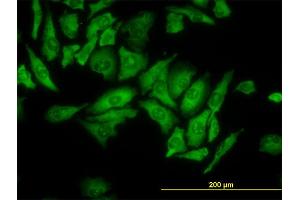 Immunofluorescence of monoclonal antibody to RPL4 on HeLa cell. (RPL4 antibody  (AA 251-350))