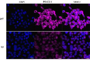 Immunocytochemical staining of HeLa cells using PRKCSH antibody (ABIN7799984), 1:1,000), Top panel: wild-type (WT), Bottom panal: PRKCSH shRNA knockdown (KD).