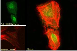 ABIN185086 Immunofluorescence analysis of paraformaldehyde fixed U2OS cells, permeabilized with 0. (Anillin antibody  (C-Term))