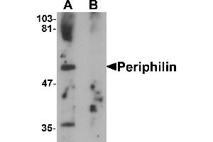 Western blot analysis of Periphilin in mouse colon tissue lysate with Periphilin antibody at 1 µg/mL in (A) the absence and (B) the presence of blocking peptide.