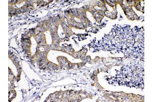 IHC analysis of TNFSF18 using anti-TNFSF18 antibody . (TNFSF18 antibody  (AA 70-199))