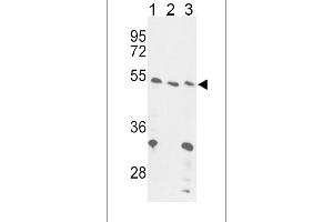 Western blot analysis of FOXP3 Antibody (C-term) (ABIN389295 and ABIN2839415) in 293(lane 1), Jurkat cell line(lane 2) and mouse liver tissue(lane 3) lysates (35 μg/lane). (FOXP3 antibody  (C-Term))