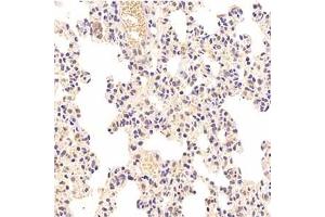 Immunohistochemistry analysis of paraffin-embedded rat lung using,HIPK2 (ABIN7074255) at dilution of 1: 1000 (HIPK2 antibody)