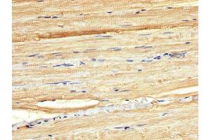IHC image of ABIN7165118 diluted at 1:300 and staining in paraffin-embedded human skeletal muscle tissue performed on a Leica BondTM system. (BORA antibody  (AA 178-312))