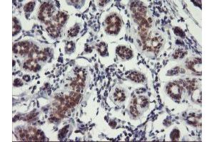Image no. 1 for anti-Ubiquitin Specific Peptidase 10 (USP10) antibody (ABIN1501688) (USP10 antibody)