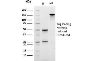 SDS-PAGE Analysis Purified LLC Recombinant Mouse Monoclonal Antibody (rLLC/3777). (Recombinant IgL antibody)