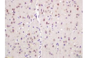 Formalin-fixed and paraffin embedded mouse brain labeled with Rabbit Anti-NARC1 Polyclonal Antibody, Unconjugated (ABIN761831) at 1:200 followed by conjugation to the secondary antibody and DAB staining (PCSK9 antibody  (AA 231-330))
