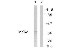 Western blot analysis of extract from MDA-MB-435 cells, using MKK3 (Ab-189) antibody (E021116). (MAP2K3 antibody)