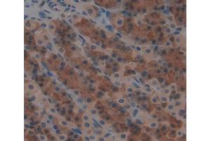 Immunohistochemistry (IHC) image for anti-Glutaminyl-tRNA Synthetase (QARS) (AA 2-206) antibody (ABIN5013625)