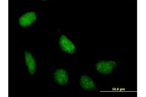 Immunofluorescence of purified MaxPab antibody to SIRT7 on HeLa cell. (SIRT7 antibody  (AA 1-400))