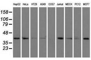 Image no. 7 for anti-Acetyl-CoA Acetyltransferase 2 (ACAT2) antibody (ABIN1496403) (ACAT2 antibody)