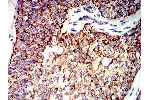 Immunohistochemistry (IHC) image for anti-BCL2-Antagonist/killer 1 (BAK1) (AA 29-187) antibody (ABIN5611250)