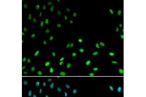 Immunofluorescence analysis of MCF-7 cells using RFC1 Polyclonal Antibody (RFC1 antibody)