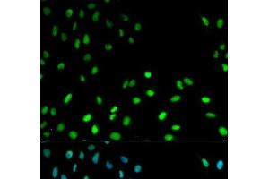 Immunofluorescence analysis of MCF-7 cells using RFC1 Polyclonal Antibody