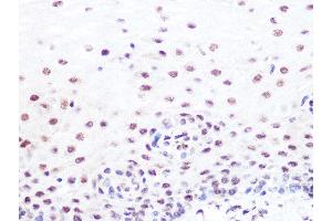 Immunohistochemistry of paraffin-embedded human esophageal using SUMO2/3 Rabbit mAb (ABIN7270370) at dilution of 1:100 (40x lens). (SUMO2 antibody)