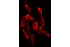 ABIN6279864 staining 293 by IF/ICC. (SYT10 antibody)