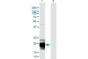 Western Blot analysis of IL23A expression in transfected 293T cell line by IL23A monoclonal antibody (M01), clone 4C8. (IL23A antibody  (AA 1-189))
