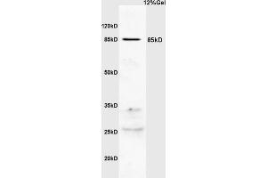 Human colon carcinoma lysates probed with Anti PI 3 Kinase p85 beta Polyclonal Antibody, Unconjugated (ABIN754723) at 1:200 overnight at 4 °C. (PIK3R2 antibody)