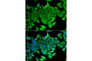 Immunofluorescence analysis of A549 cells using TTF2 antibody. (TTF2 antibody  (AA 1-270))