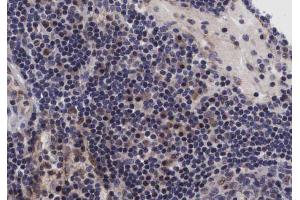 ABIN6267432 at 1/200 staining human lymph nodes tissue sections by IHC-P. (NFKB1 antibody  (pSer907))
