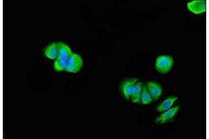 Immunofluorescent analysis of MCF-7 cells using ABIN7172041 at dilution of 1:100 and Alexa Fluor 488-congugated AffiniPure Goat Anti-Rabbit IgG(H+L) (TMX2 antibody  (AA 49-102))