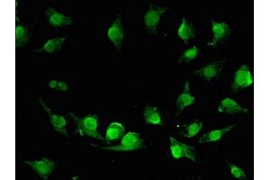 Immunofluorescent analysis of U251 cells using ABIN7175308 at dilution of 1:100 and Alexa Fluor 488-congugated AffiniPure Goat Anti-Rabbit IgG(H+L) (VPS33A antibody  (AA 1-300))