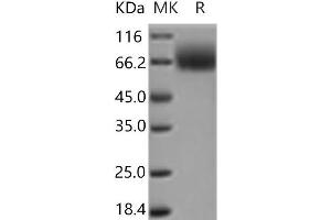 TRKB Protein (His tag)