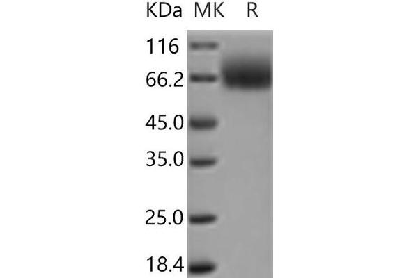 TRKB Protein (His tag)