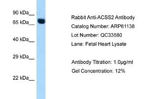Western Blotting (WB) image for anti-Acyl-CoA Synthetase Short-Chain Family Member 2 (ACSS2) (C-Term) antibody (ABIN2788691)
