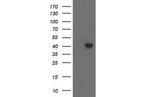 HEK293T cells were transfected with the pCMV6-ENTRY control (Left lane) or pCMV6-ENTRY ACAT2 (Right lane) cDNA for 48 hrs and lysed. (ACAT2 antibody)