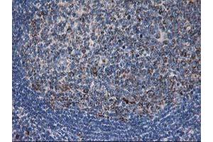 Image no. 1 for anti-Dihydrolipoamide Dehydrogenase (DLD) antibody (ABIN1497847) (DLD antibody)