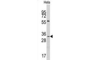 Western Blotting (WB) image for anti-Melanoma Antigen Family A, 1 (Directs Expression of Antigen MZ2-E) (MAGEA1) antibody (ABIN3002531)