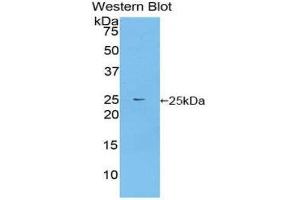 Western Blotting (WB) image for anti-Fibroblast Growth Factor Receptor Substrate 2 (FRS2) (AA 268-453) antibody (ABIN1858918) (FRS2 antibody  (AA 268-453))